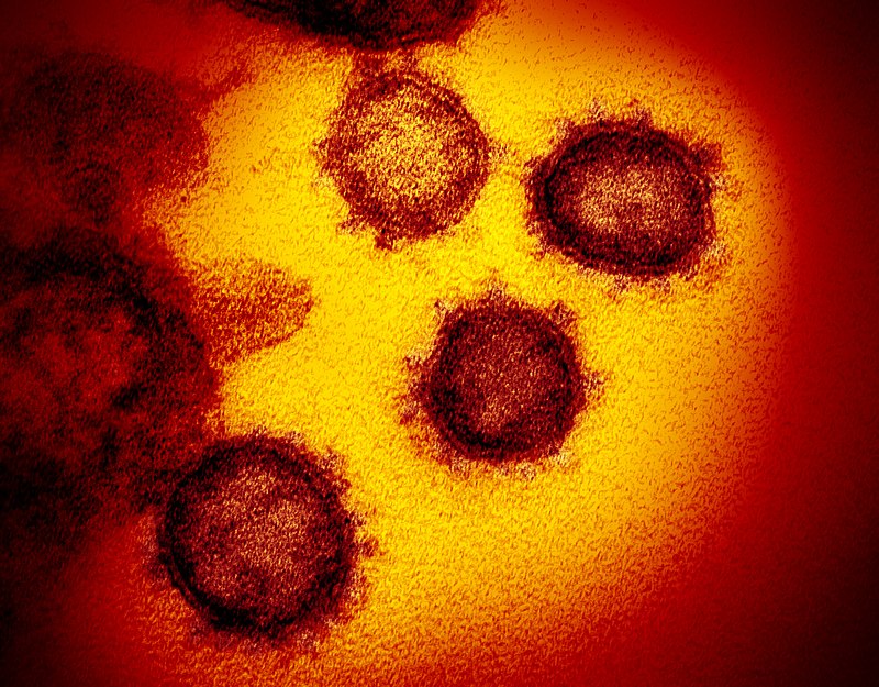 SARS-CoV-2 humán koronavírus pásztázó elektronmikroszkópos képe